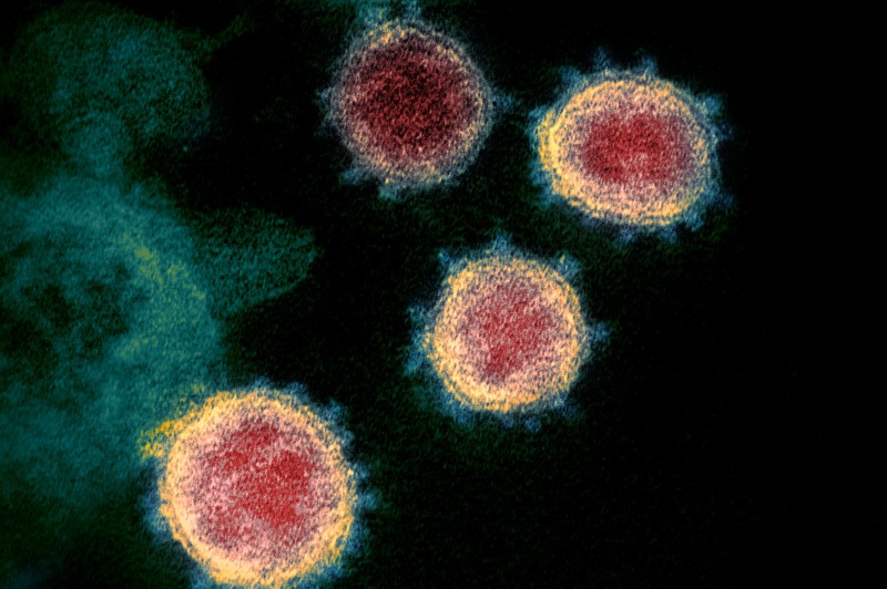 Le coronavirus du syndrome respiratoire aigu sévère 2 Photo : NIAID Rocky Mountain Laboratories (RML)